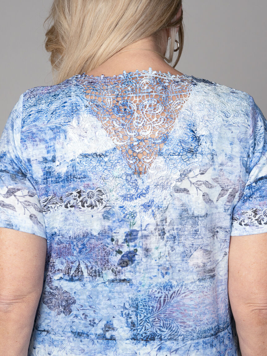Short Sleeve Top With Lace Back